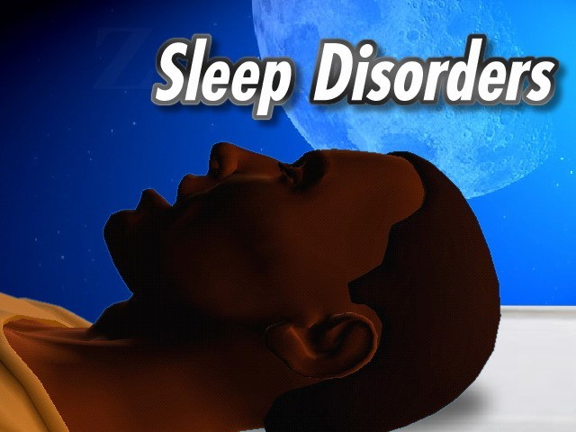 deep sleep after seizure